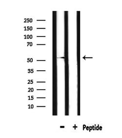 Invitrogen DRD2 Polyclonal Antibody 100 &mu;L; Unconjugated:Antibodies,