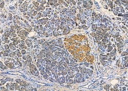 Invitrogen Desmoglein 3 Polyclonal Antibody 100 &mu;L; Unconjugated:Antibodies,