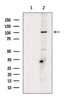 Invitrogen Desmoglein 3 Polyclonal Antibody 100 &mu;L; Unconjugated:Antibodies,