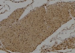Invitrogen DVL3 Polyclonal Antibody 100 &mu;L; Unconjugated:Antibodies,