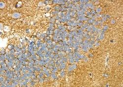 Invitrogen DYNC1H1 Polyclonal Antibody 100 &mu;L; Unconjugated:Antibodies,