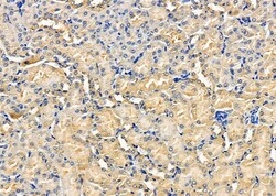 Invitrogen EBI3 Polyclonal Antibody 100 &mu;L; Unconjugated:Antibodies,