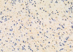 Invitrogen EBI3 Polyclonal Antibody 100 &mu;L; Unconjugated:Antibodies,