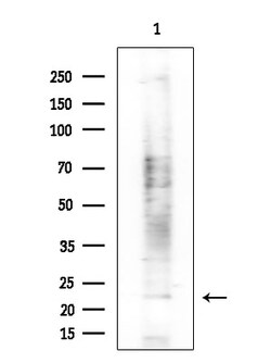 Invitrogen EBI3 Polyclonal Antibody 100 &mu;L; Unconjugated:Antibodies,