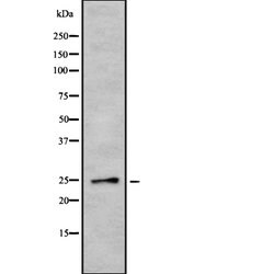 Invitrogen EBI3 Polyclonal Antibody 100 &mu;L; Unconjugated:Antibodies,