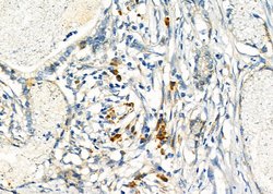 EDEM3 Polyclonal Antibody:Antibodies, Polyclonal