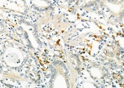 EDEM3 Polyclonal Antibody:Antibodies, Polyclonal
