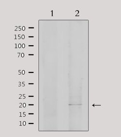 Invitrogen EID1 Polyclonal Antibody 100 &mu;L; Unconjugated:Antibodies,