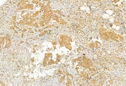 Invitrogen eIF4A3 Polyclonal Antibody 100 &mu;L; Unconjugated:Antibodies,