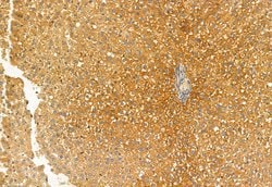 Invitrogen eIF4A3 Polyclonal Antibody 100 &mu;L; Unconjugated:Antibodies,