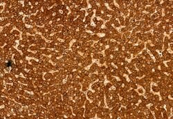 Invitrogen eIF4A3 Polyclonal Antibody 100 &mu;L; Unconjugated:Antibodies,