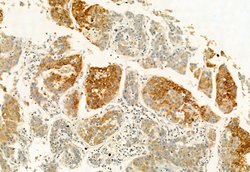 Invitrogen eIF4A3 Polyclonal Antibody 100 &mu;L; Unconjugated:Antibodies,