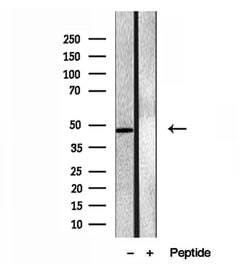 Invitrogen eIF4A3 Polyclonal Antibody 100 &mu;L; Unconjugated:Antibodies,