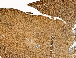 Invitrogen CELA3B Polyclonal Antibody 100 &mu;L; Unconjugated:Antibodies,