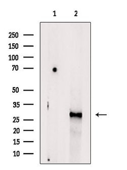 Invitrogen CELA3B Polyclonal Antibody 100 &mu;L; Unconjugated:Antibodies,