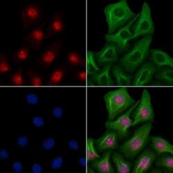 ELOA Polyclonal Antibody, Invitrogen 100 &mu;L; Unconjugated:Antibodies,