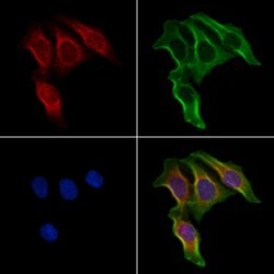 Invitrogen ELOVL5 Polyclonal Antibody 100 &mu;L; Unconjugated:Antibodies,