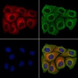 Invitrogen Endomucin Polyclonal Antibody 100 μL; Unconjugated:Antibodies,