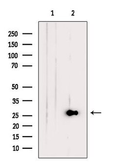 Invitrogen Endomucin Polyclonal Antibody 100 μL; Unconjugated:Antibodies,