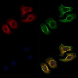 Invitrogen EPHA3 Polyclonal Antibody 100 &mu;L; Unconjugated:Antibodies,