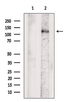 Invitrogen EPHA3 Polyclonal Antibody 100 &mu;L; Unconjugated:Antibodies,