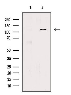 Invitrogen EPHA3 Polyclonal Antibody 100 &mu;L; Unconjugated:Antibodies,