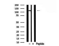 Invitrogen EPHA3 Polyclonal Antibody 100 &mu;L; Unconjugated:Antibodies,