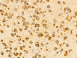 EphA7 Polyclonal Antibody:Antibodies, Polyclonal