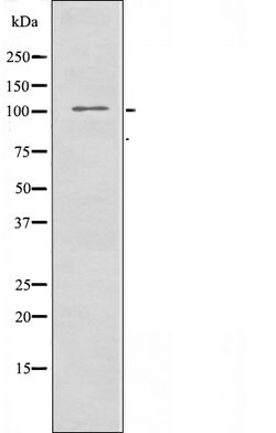 EphA7 Polyclonal Antibody:Antibodies, Polyclonal