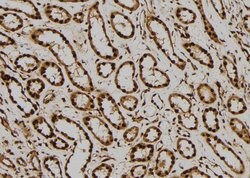 Invitrogen ERK2 Polyclonal Antibody 100 &mu;L; Unconjugated:Antibodies,