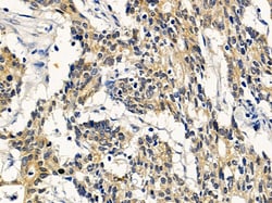 Invitrogen ERLIN1 Polyclonal Antibody 100 &mu;L | Buy Online | Invitrogen&trade; | Fisher Scientific