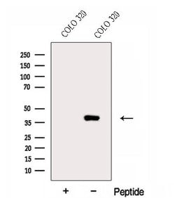 Invitrogen ERLIN1 Polyclonal Antibody 100 &mu;L | Buy Online | Invitrogen&trade; | Fisher Scientific