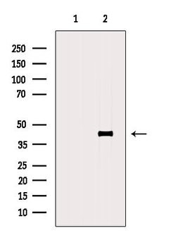 Invitrogen ERLIN1 Polyclonal Antibody 100 &mu;L | Buy Online | Invitrogen&trade; | Fisher Scientific