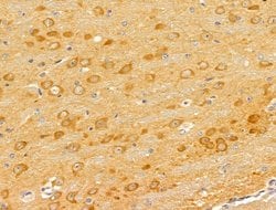 Invitrogen Flotillin 2 Polyclonal Antibody 100 &mu;L | Buy Online | Invitrogen&trade; | Fisher Scientific