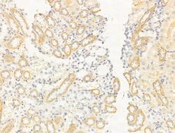 Invitrogen Flotillin 2 Polyclonal Antibody 100 &mu;L | Buy Online | Invitrogen&trade; | Fisher Scientific