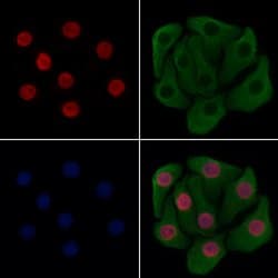Invitrogen XPO5 Polyclonal Antibody 100 &mu;L; Unconjugated:Antibodies,