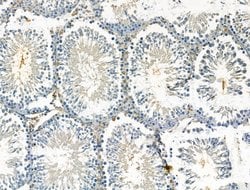 Invitrogen XPO5 Polyclonal Antibody 100 &mu;L; Unconjugated:Antibodies,