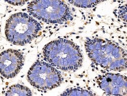 Invitrogen XPO5 Polyclonal Antibody 100 &mu;L; Unconjugated:Antibodies,