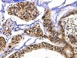 Invitrogen XPO5 Polyclonal Antibody 100 &mu;L; Unconjugated:Antibodies,