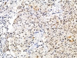 Invitrogen XPO5 Polyclonal Antibody 100 &mu;L; Unconjugated:Antibodies,