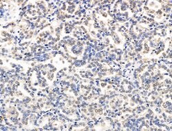 Invitrogen XPO5 Polyclonal Antibody 100 &mu;L; Unconjugated:Antibodies,