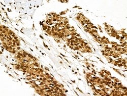 Invitrogen XPO5 Polyclonal Antibody 100 &mu;L; Unconjugated:Antibodies,