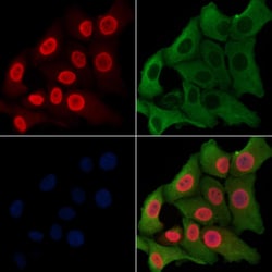 Invitrogen EZH1 Polyclonal Antibody 100 &mu;L; Unconjugated:Antibodies,