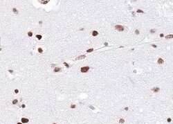 Invitrogen EZH1 Polyclonal Antibody 100 &mu;L; Unconjugated:Antibodies,
