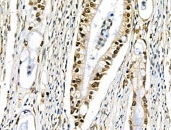 Invitrogen EZH1 Polyclonal Antibody 100 &mu;L; Unconjugated:Antibodies,