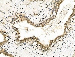 Invitrogen EZH1 Polyclonal Antibody 100 &mu;L; Unconjugated:Antibodies,
