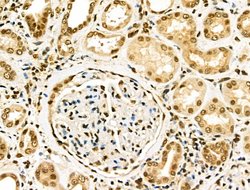 Invitrogen EZH1 Polyclonal Antibody 100 &mu;L; Unconjugated:Antibodies,