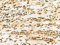 Invitrogen EZH1 Polyclonal Antibody 100 &mu;L; Unconjugated:Antibodies,