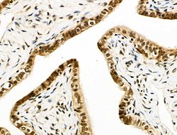 Invitrogen EZH1 Polyclonal Antibody 100 &mu;L; Unconjugated:Antibodies,