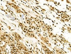 Invitrogen EZH1 Polyclonal Antibody 100 &mu;L; Unconjugated:Antibodies,